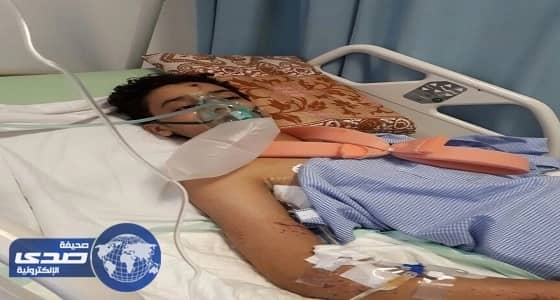 أطباء مستشفى عسير ينهون معاناة مواطن بعملية جراحية استمرت 9 ساعات