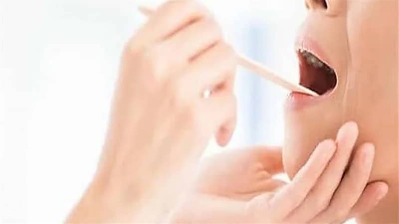 علامة تظهر على اللسان تشير إلى الإصابة بالسرطان
