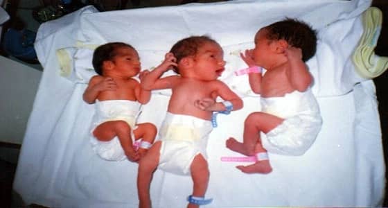 الصحة تحقق في وفاة 3 توائم بولادة الدمام
