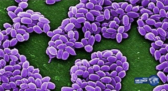 إصابة 20 من رعاة حيوان الرنة بالجمرة الخبيثة في روسيا