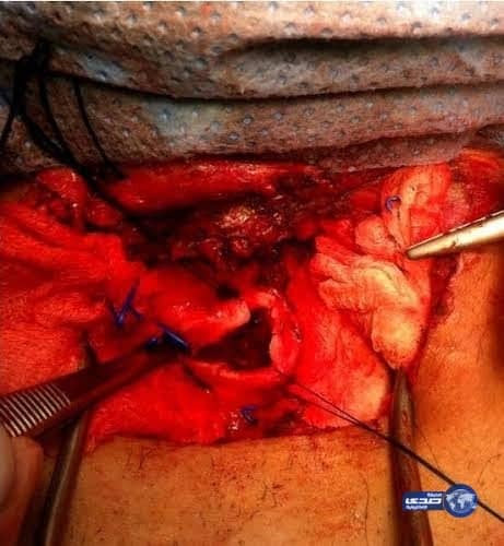 التعليم : تعتمد شعارها القديم فى إفتتاح مبناها بالرياض وتتجاهل الجديد !