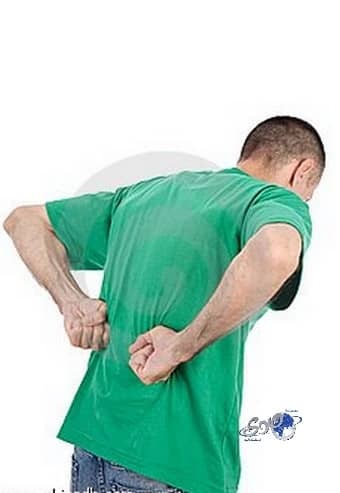 حصوات الكلية .. كيف نمنع تكرار الإصابة بها 