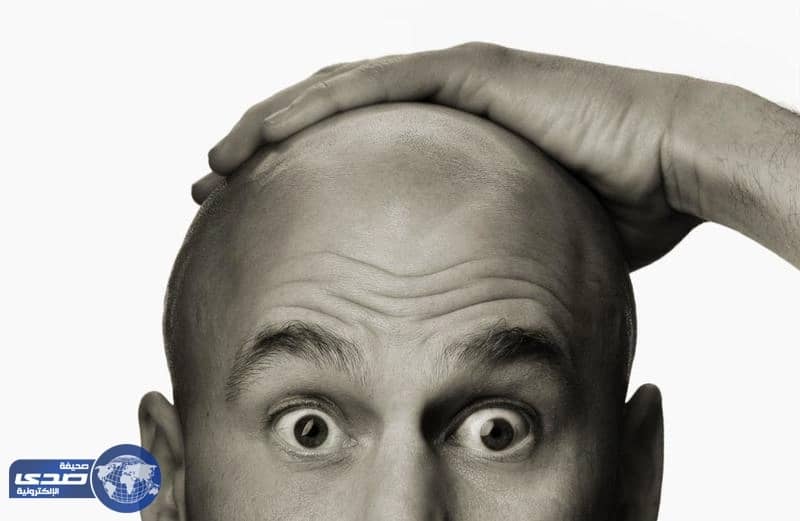 تعرف على مستوى جاذبية الرجل الأصلع لدى المرأة