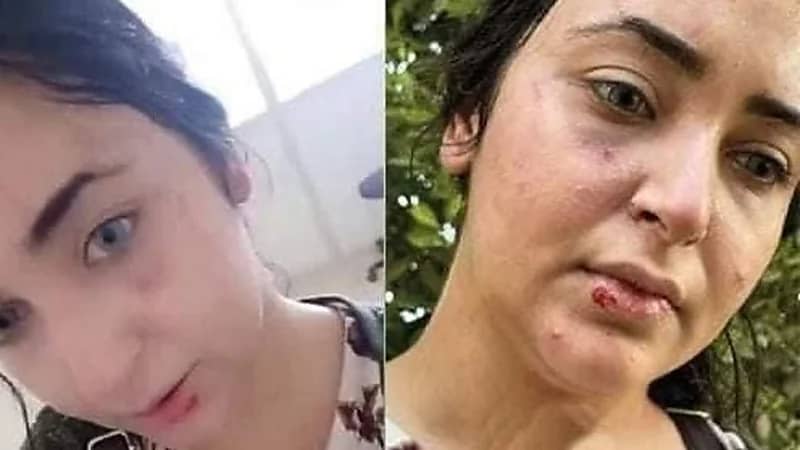 شاهد.. صيدلانية تتعرض للضرب والسحل لسبب غريب