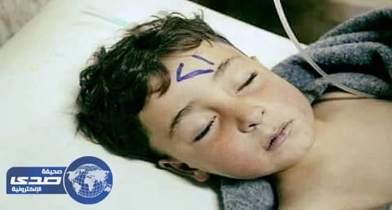 بالصور.. طفل سوري يعود للحياة بعد احتسابه شهيدا