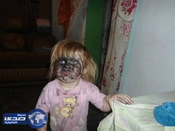 بالصور.. كوارث أطفال جلسوا بمفردهم بالمنزل