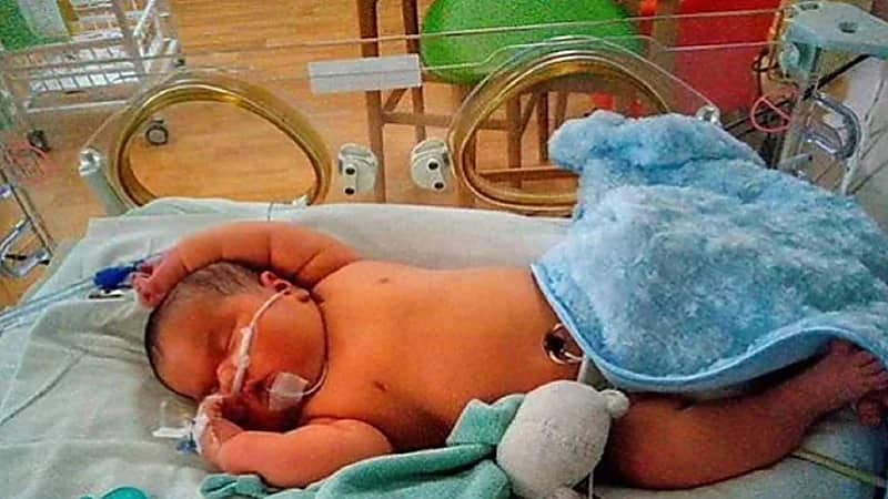 امرأة تنجب طفل وزنه يتجاوز الـ 6كيلو جرام