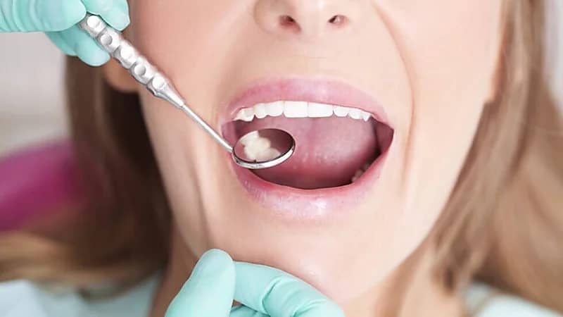  علامات في الفم تشير إلى وجود 4 حالات صحية قاتلة