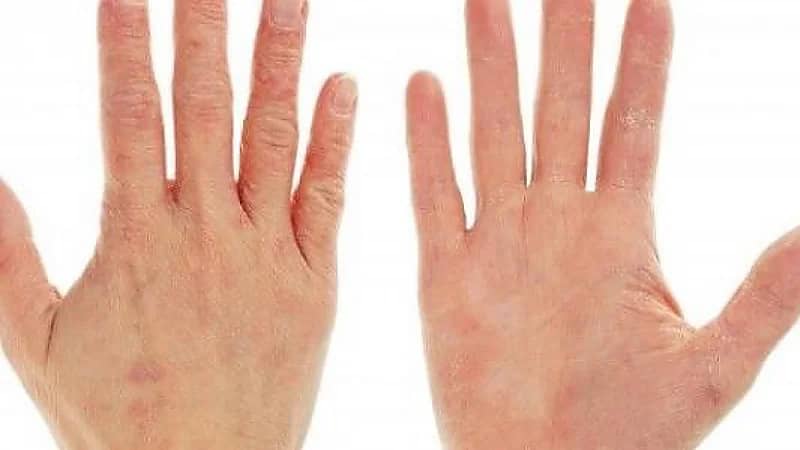 "الصحة" تقدم نصائح مهمة للحفاظ على الجلد من الجفاف في فصل الشتاء