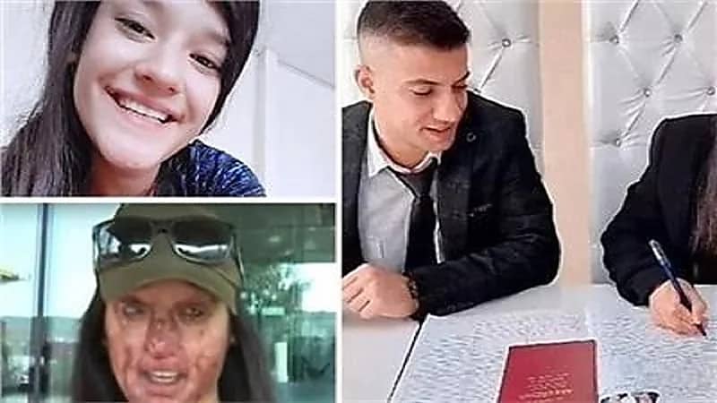 شاب يشوه وجه حبيبته لتتزوج منه