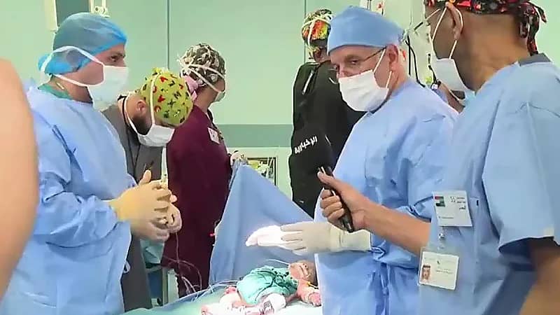 نجاح عملية فصل التوأم السيامي اليمني "سلمان وعبد الله" (فيديو)