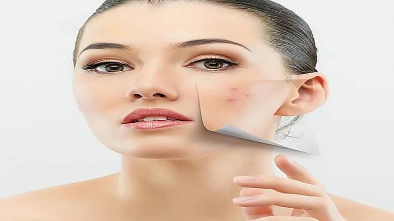 خطوات للحفاظ على البشرة من حب الشباب