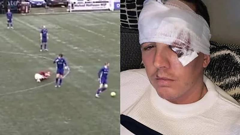 شاهد.. لاعب ينطح منافسه بوحشية خلال مباراة كرة قدم