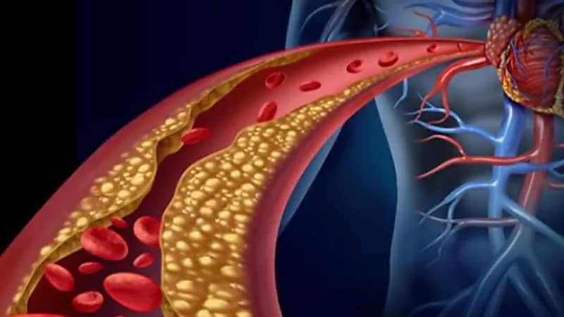 5 نصائح لخفض معدلات الكوليسترول بالجسم