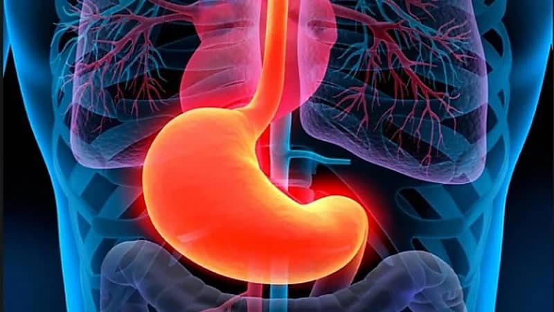 "الذيابي" يوضح أسباب التهاب المعدة المزمن