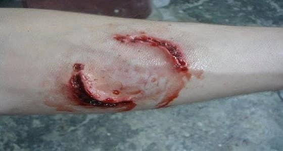 " الطاعون " ينقذ موقوف بالحقوق الأمنية من عضة فأر