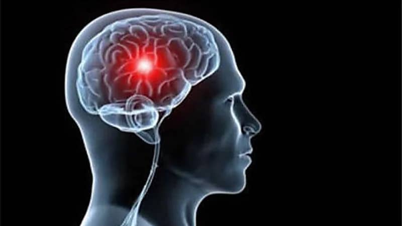 أعراض للجلطات تظهر فجأة وتسبب الوفاة