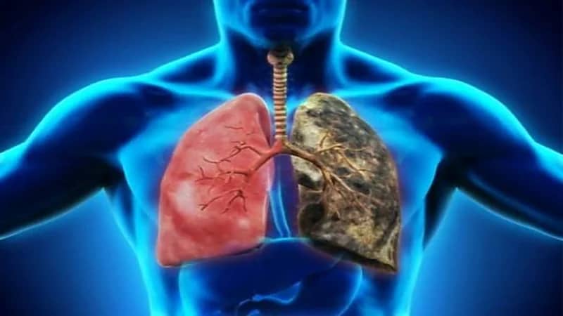 "النمر" يحذر من معلومة خاطئة بشأن تنظيف الرئتين للمدخنين