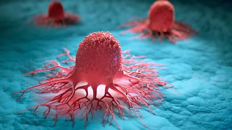 ابتكار طريقة جديدة لقتل الخلايا السرطانية