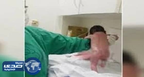 أطباء يكشفون حقيقة فيديو " الطفلة المعجزة "