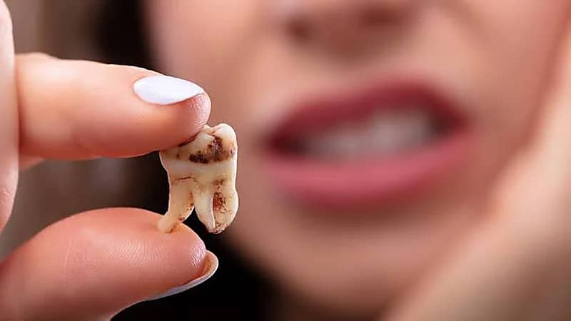 طرق الاعتناء بالأسنان وحمايتها من التسوس دون التخلي عن تناول الحلويات