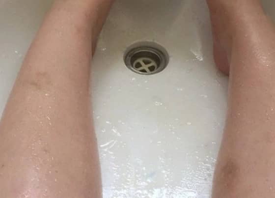 بالصورة..استرالية توجه رسالة استغاثة من الحمام : أنقذوني