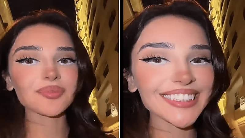 فتاة تجري عملية لتحويل أسنانها لأنياب ثعلب..فيديو