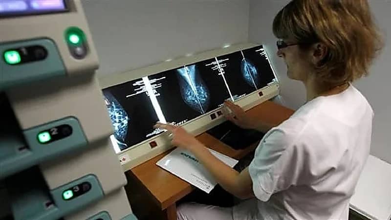 اكتشاف علاج يقلل من خطر تكرار الإصابة بـ سرطان الثدي