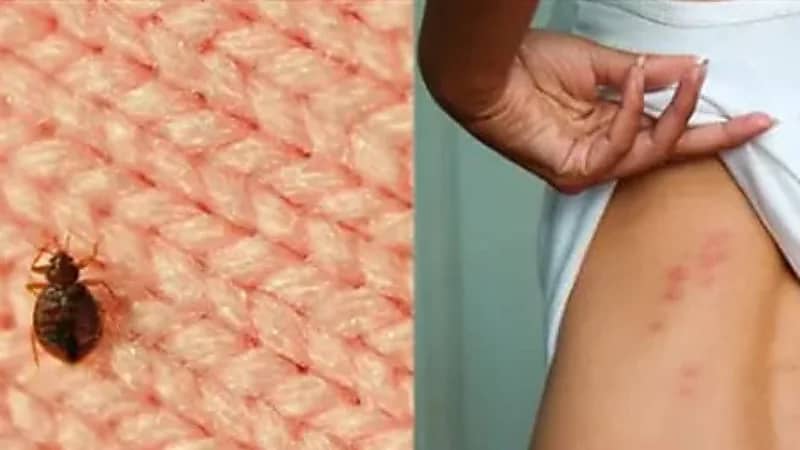 3 علامات تدل على وجود بق الفراش في المنزل