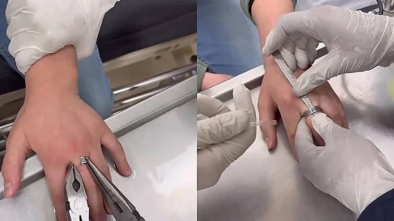 مدني الرياض ينجح في تحرير إصبع شخص عَلِقَ بقطعة معدنية   .. فيديو