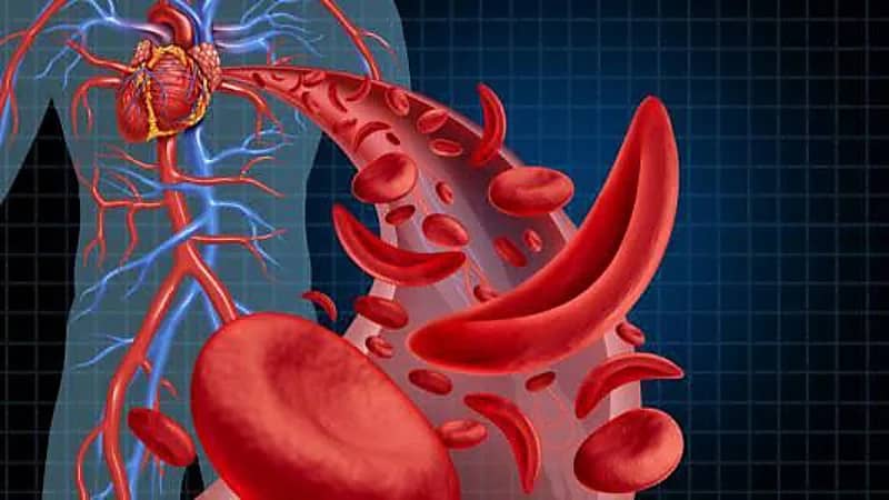 مشكلات الجهاز الهضمي: سبب خفي وراء نقص الحديد وفقر الدم