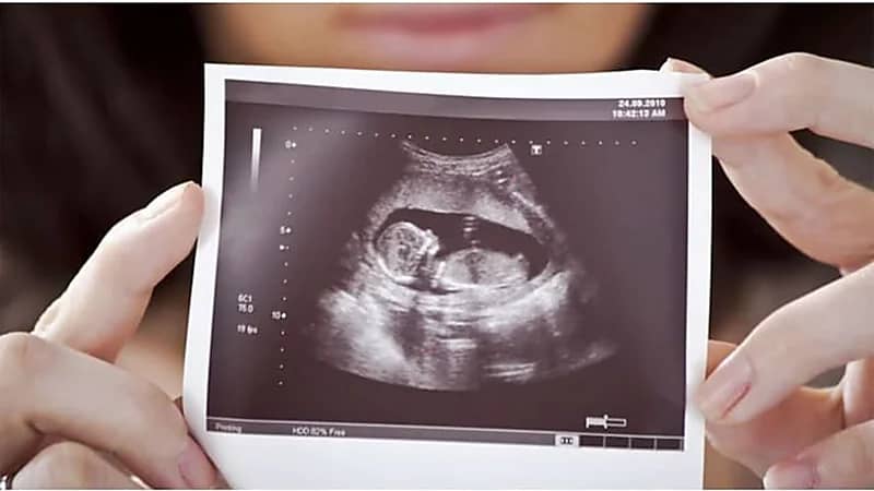 هل يمكن معرفة جنس الجنين من التغيرات الجسدية أثناء الحمل؟ استشاري يُجيب