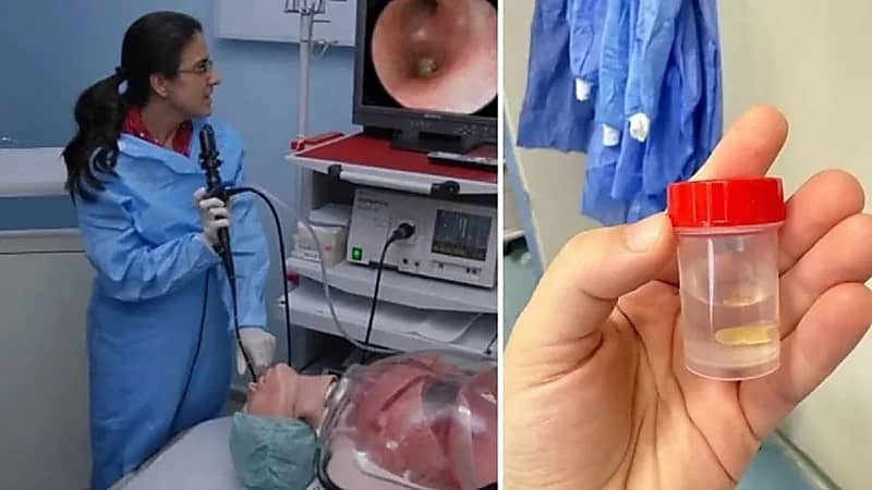 حبة ذرة كادت أن تودي بحياة سيدة