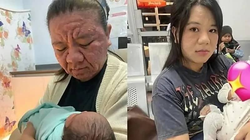 امرأة ماليزية توثق تغير ملامح وجهها خلال الحمل.. صور