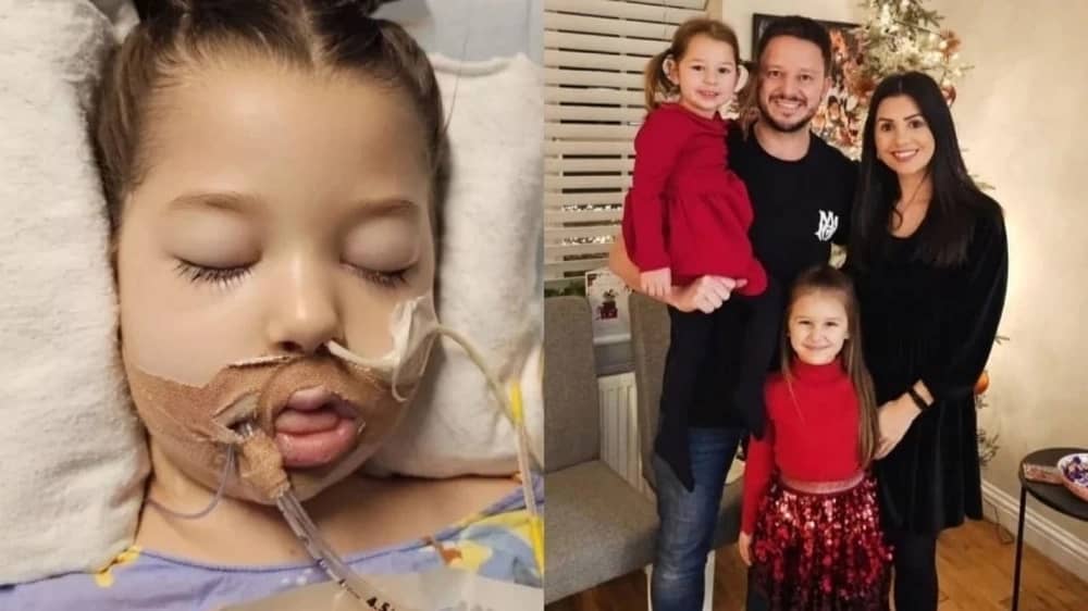 طفلة بريطانية تصارع الموت بعد مضاعفات نادرة للإنفلونزا