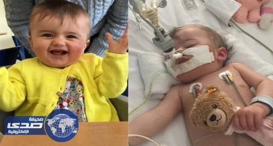 خطأ طبي يكلّف طفلة جزءًا من نظرها وسمعها