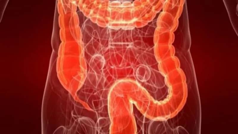 الخضيري: التوتر والقلق أبرز مسببات تهيج القولون