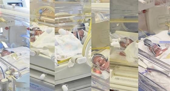 في حالة نادرة..أم لأربع أطفال تلد 6 توائم