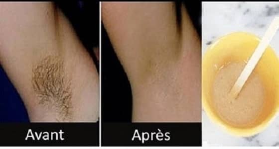 وصفة جديدة للتخلص من الشعر الزائد بدون أضرار