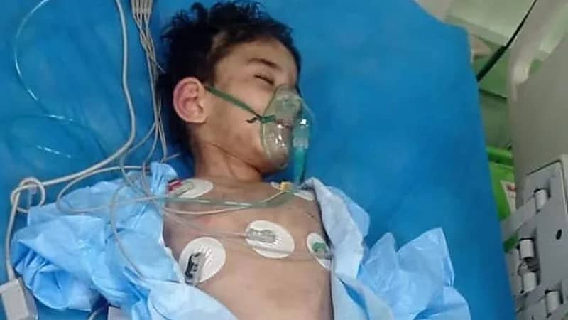 مأساة جديدة لطفل عنفته زوجة أبيه وكسرت عظامه في العراق