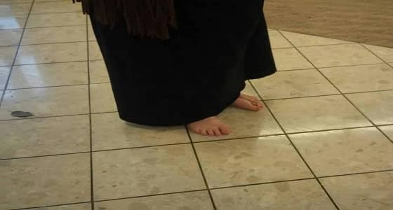 فتاة تقضي 3 سنوات حافية