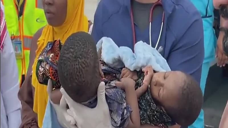 نقل السيامي التنزاني إلى الرياض عبر الإخلاء الطبي.. فيديو