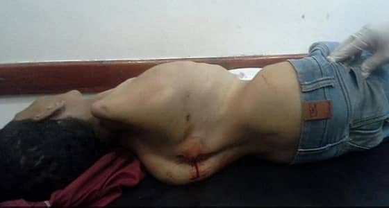 الحوثيون يقتلون طفلا معاقا في تعز