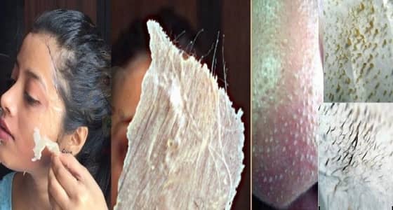 وصفة سحرية للتخلص من الرؤوس السوداء وشعر الوجه في 3 أيام