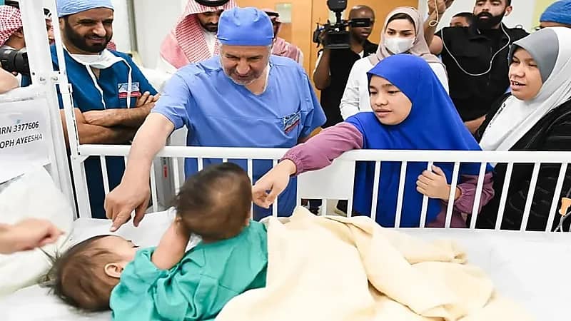 بدء عملية فصل التوأم السيامي الفلبيني بمستشفى الملك عبدالله التخصصي للأطفال بالرياض