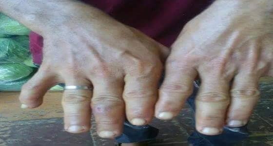 اتلاف 210 كيلو أرز و 4500 ملفوف في مطعم  ببحرة