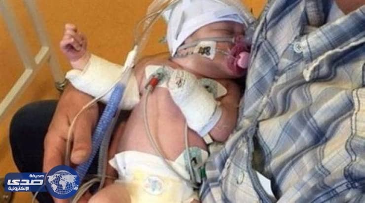 أب ينقذ طفلته الرضيعة من الموت عقب ملاحظته بٌكاءها بطريقة غريبة