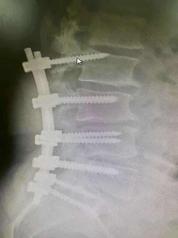 شاهد.. لحظة اقتحام سيارة لصيدلية وتحطيم واجهتها الزجاجية في المدينة