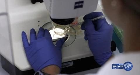 دراسة بحثية : تطور علمي جديد قد ينهي معاناة مرضى الكُلى إلى الأبد