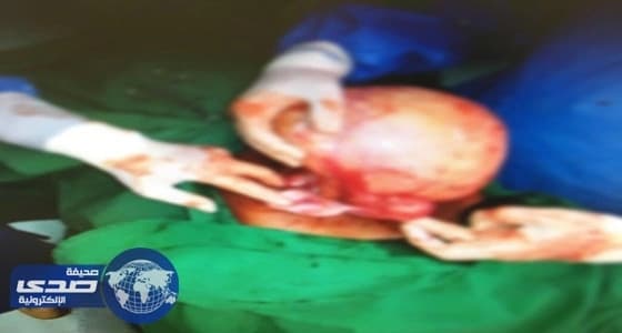 بالفيديو.. وصول أول نسخ بوجاتي شيرون إلى أمريكا